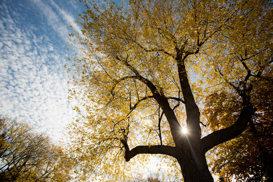 Rickets and Vitamin D
